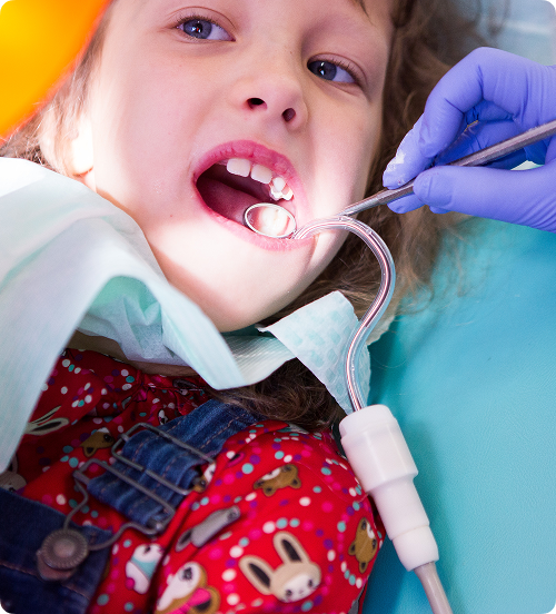 À quel moment appliquer des scellants ?