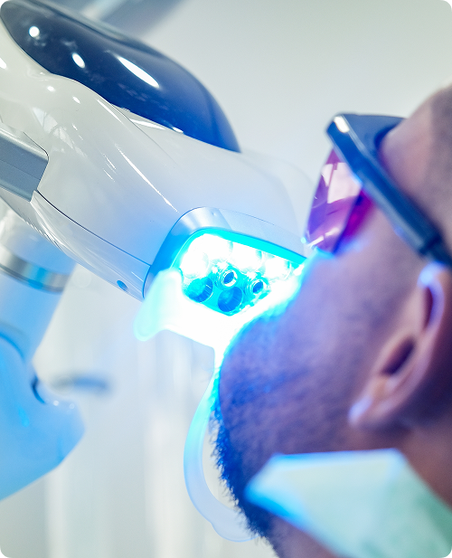 Blanchiment des dents