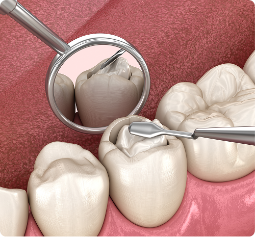 Des matériaux durables et esthétiques
