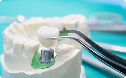 Elle est recommandée notamment dans les situations suivantes