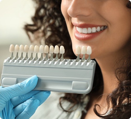 Facettes en porcelaine