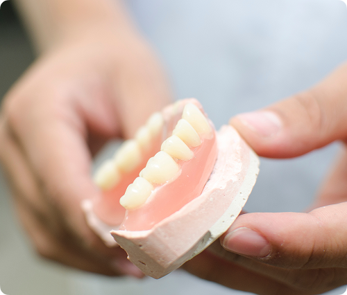 Les différents types de prothèses offertes