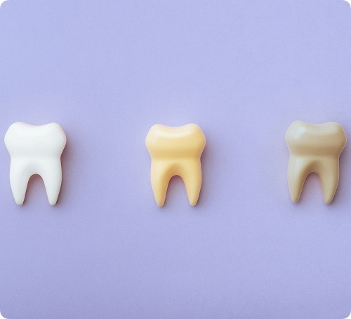 Pour quels types de taches ou jaunissement ?