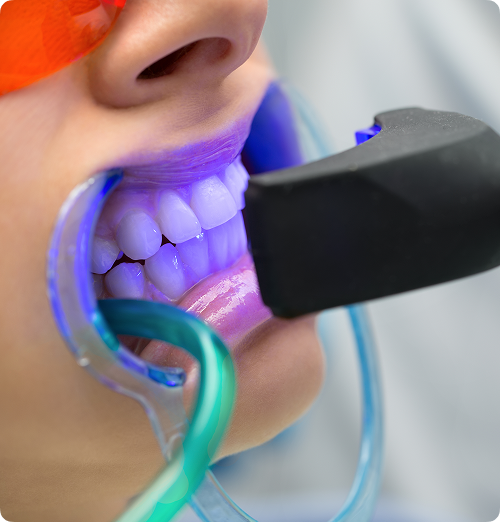 Pourquoi choisir une méthode professionnelle ?