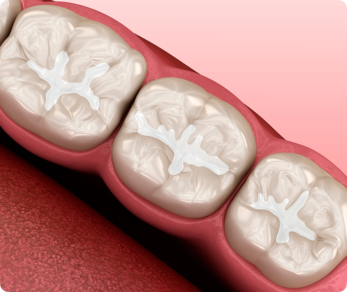 Quelle est la durée de vie d’un scellant ?