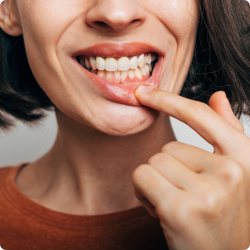 Selon la sévérité du problème, plusieurs approches sont possibles