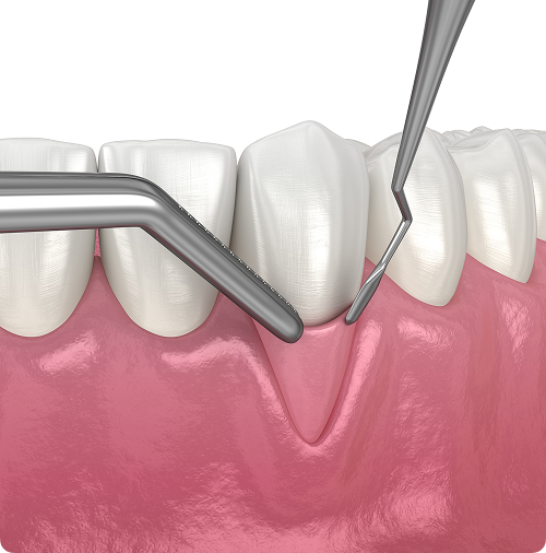 Un traitement adapté à votre condition