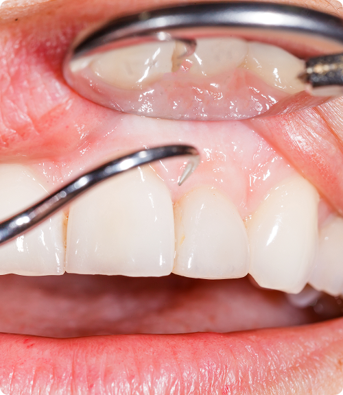 Une approche préventive et proactive