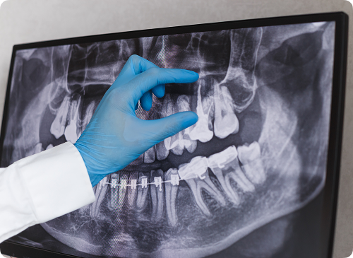 Voici les grandes étapes