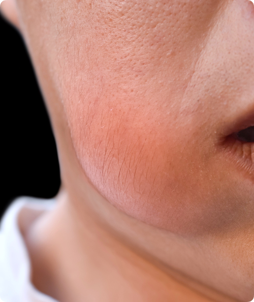 Les urgences les plus fréquentes