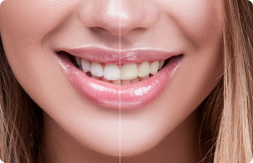 vous profitez de plusieurs avantages